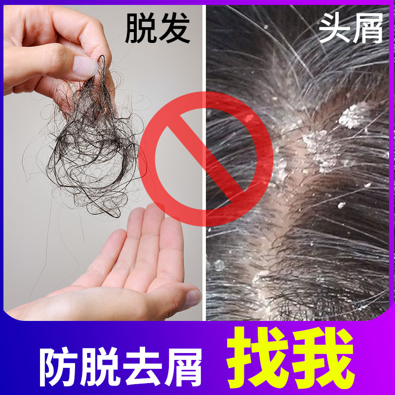 Ginger shampoo Old ginger Wang Men and women Dandruff Anti-Hair Loss Control Oil Pure Plant Natural Hair Care