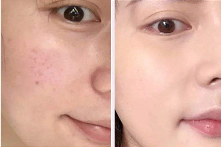 美国修丽可CF美白瓶,让自己再美一些 图7