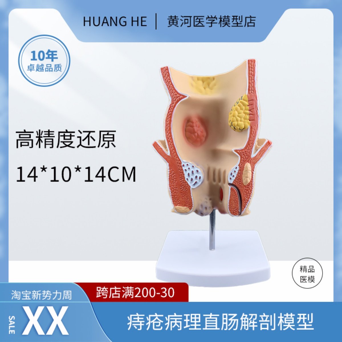 痔疮直肠病理模型 溃杨性结肠病 肠直肠解剖病理模型病态疾病教具