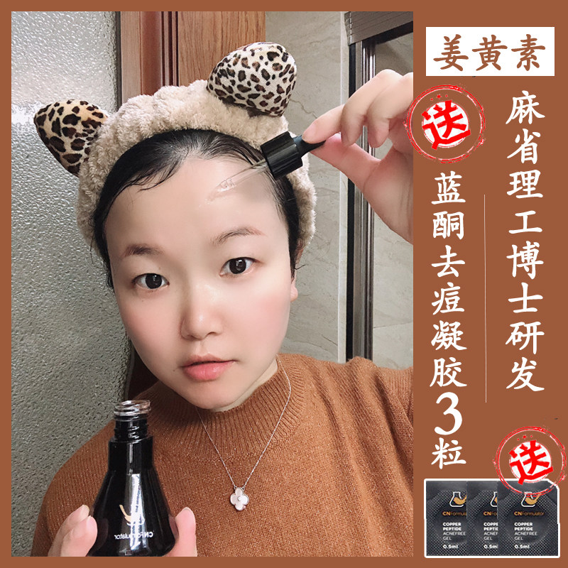 Maintenance repair of acne muscle and recipient curcumin essence 30ml brighten to yellow to improve pox print