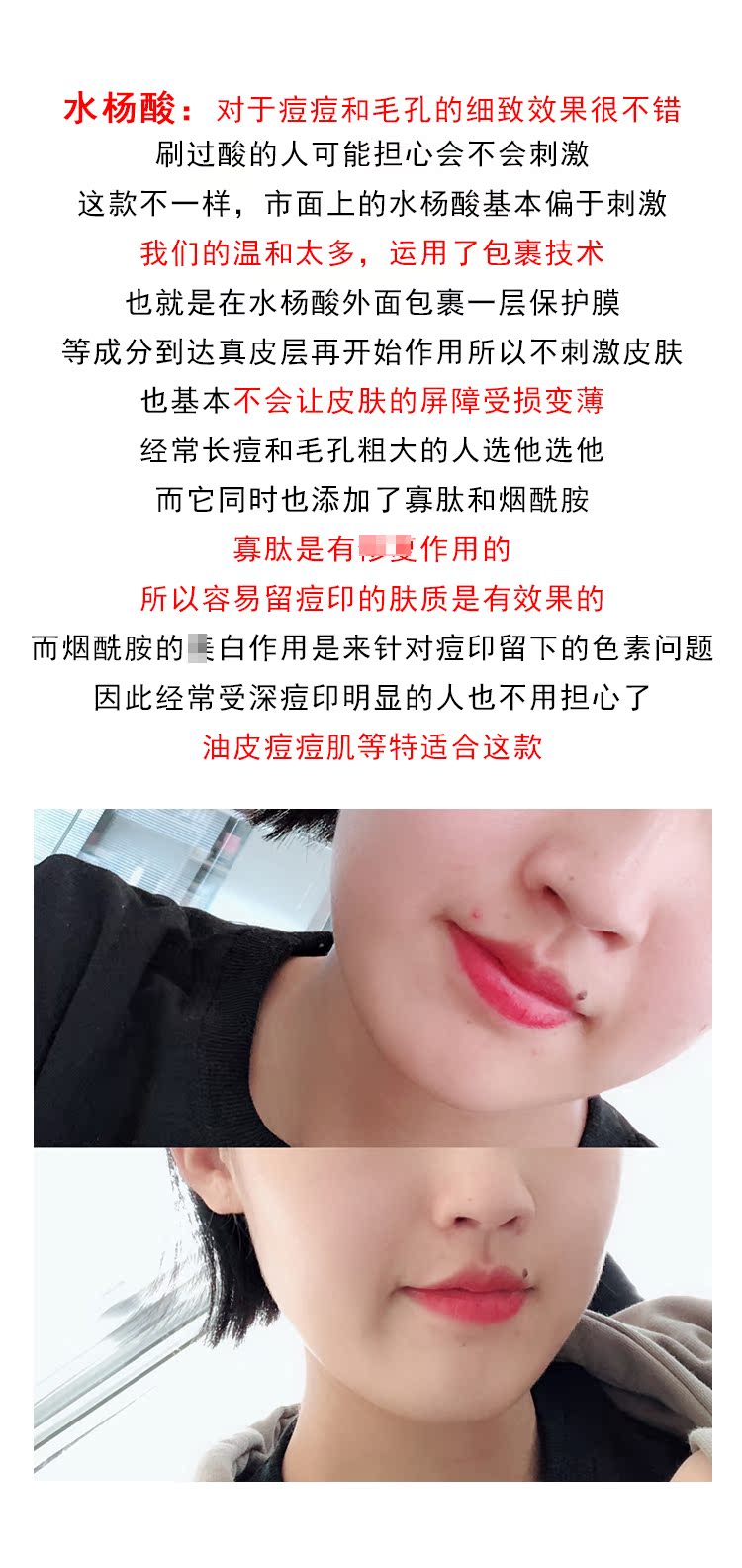 EVM hyaluronic acid dưỡng ẩm giải pháp hydrat thu nhỏ lỗ chân lông cơ dưới dạng lỏng bôi nước loại ánh sáng kim mặt tinh chất peptide