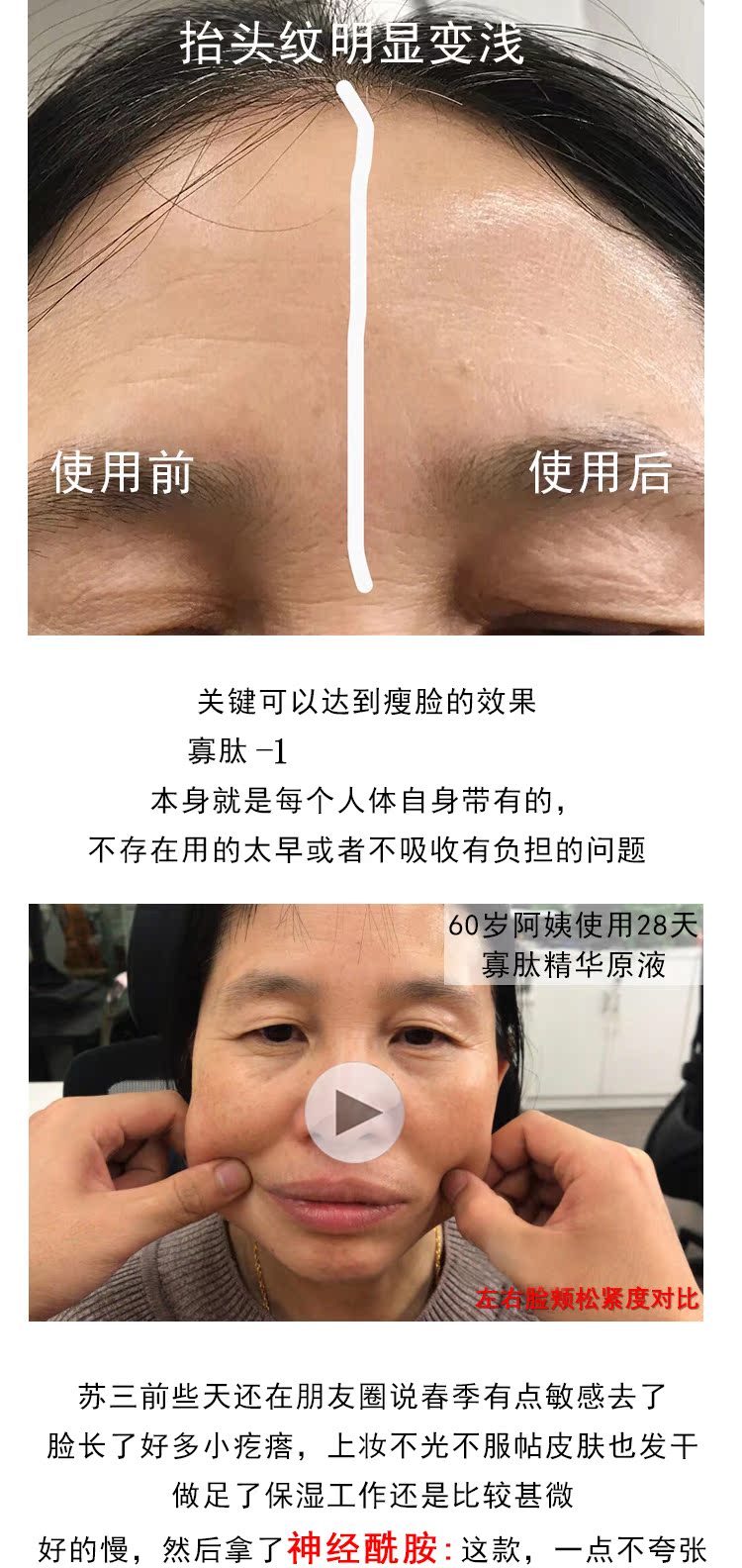 EVM hyaluronic acid dưỡng ẩm giải pháp hydrat thu nhỏ lỗ chân lông cơ dưới dạng lỏng bôi nước loại ánh sáng kim mặt tinh chất peptide