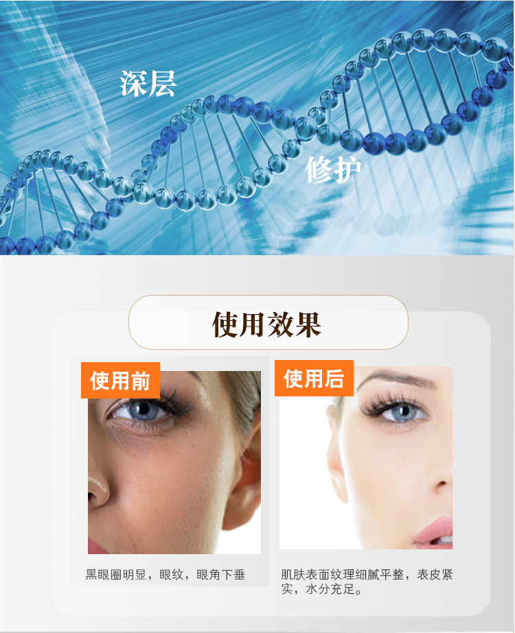 Chengmei Pinmei sẽ thắt chặt mặt nạ mắt tinh 8 cặp quầy xác thực zendo chăm sóc mắt sản phẩm chăm sóc da nhập khẩu từ Nhật Bản tẩy trang mắt