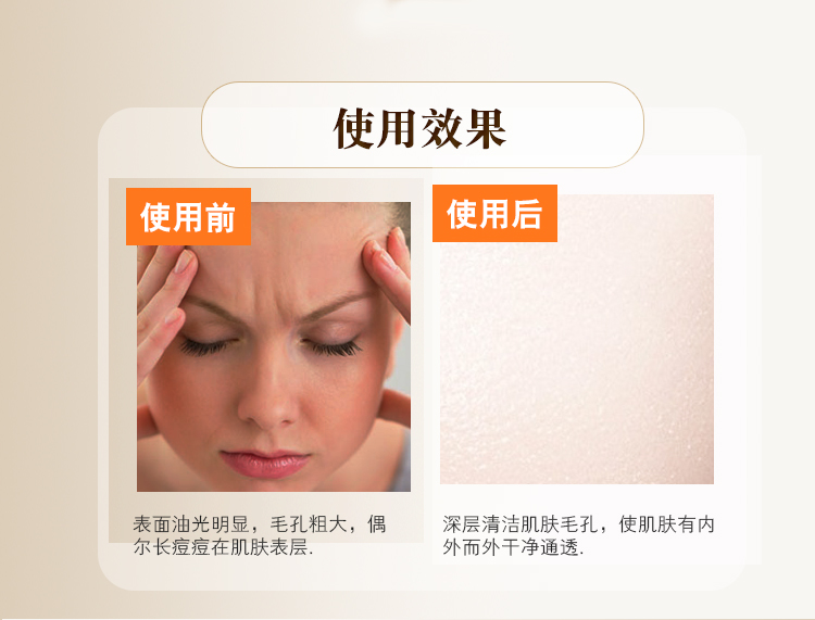 Chengmei Pinmei sẽ cân bằng các cơ dưới gel trang điểm 480 gam Shang Junfeng bệnh viện mỹ phẩm truy cập chính hãng làm sạch kem tẩy trang garnier xanh