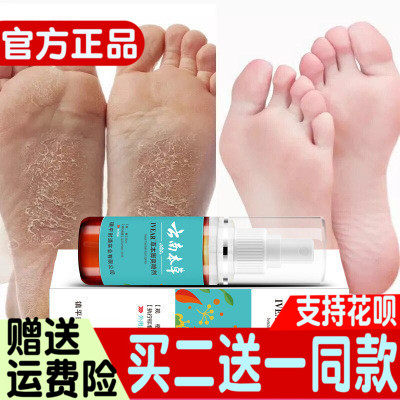Yunnan Grass Bench Bench Foot Spray Feet air foot Smelly Feet Sweat Spray Feet Foot foot Refreshing Care A Treasure