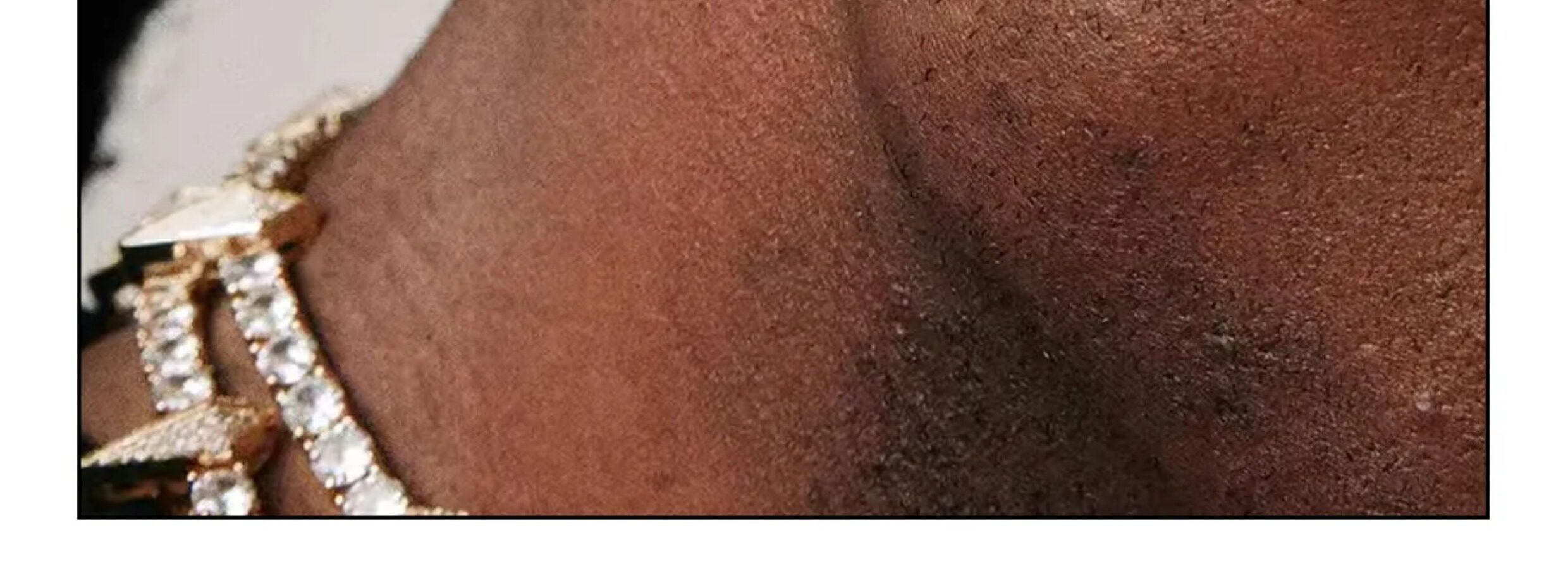 /