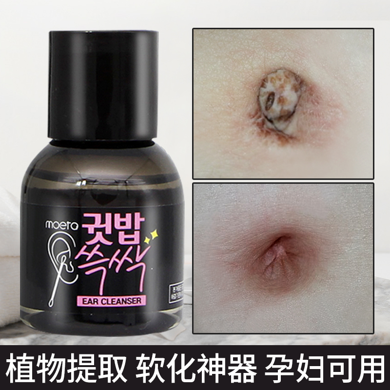 Adults special Korean belly washing navel and softened artifacts cleaning cleaning cleaning and deodoring dirt to send cotton rods