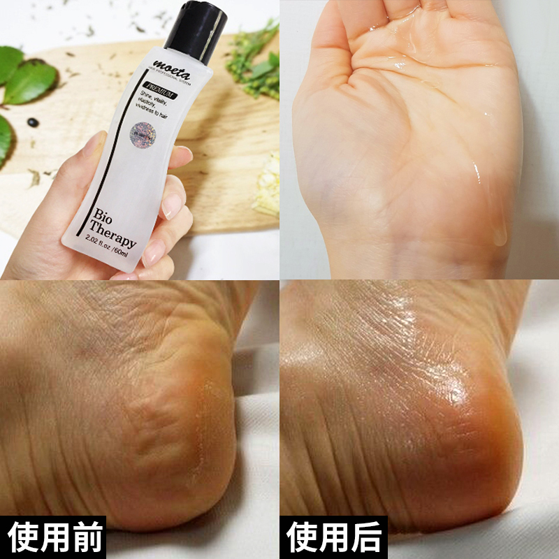 South Korea Imports Hair Care Essential Oils Facial Body Moisturizing Moisturizing Pregnant Woman Body Massage Oil Moisturizing Oil