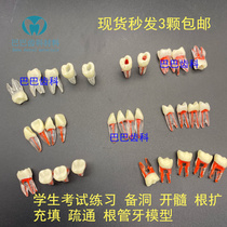Dental dentist examination Exercise open marrow-body teeth with tooth root medullary root canal dental grain practice preparation of coves