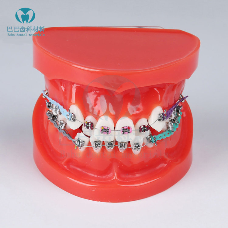 Dental Orthodontics Model Red Wrong Jaw With Trough Model Oral Teaching Teeth Correction Model 