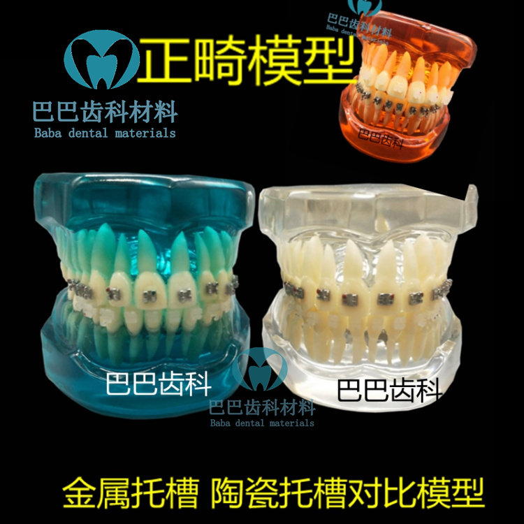 Oral Orthodontic Model Metal Self-Lock Ceramic Nursery Contrast Demonstration Tooth Correction Model Crystal 