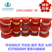 Dental orthodontic tooth malocclusion model ground-to-earth buck tooth orthodontic classification display model