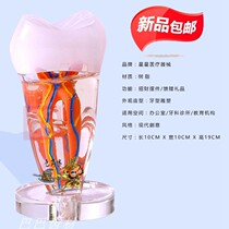 Dental Upscale Art Pendulum with bright yellow gold Line Merchants dental pulp Endodontic Nerve clear visible 10 times Strokes Tooth