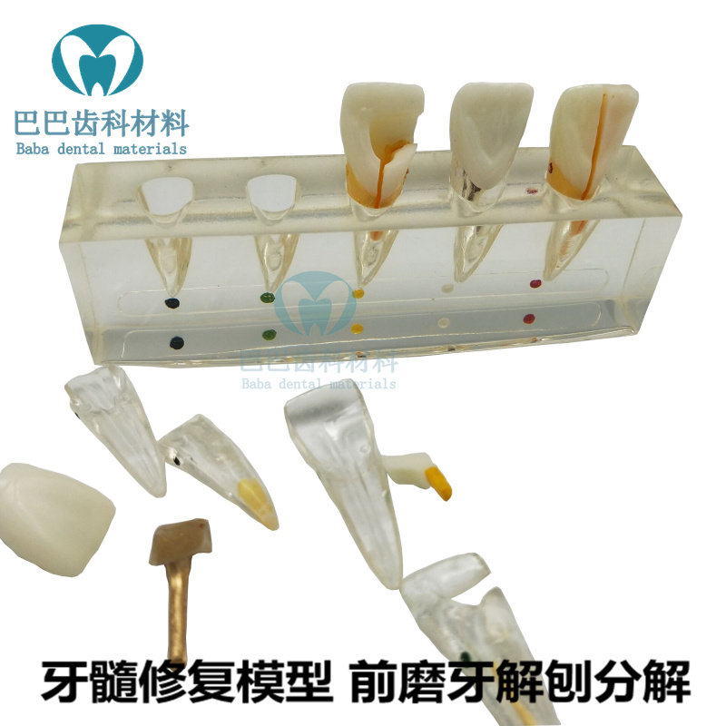 Oral model dental pulp repair model teeth deplaning decomposition model dentistry front grinding tooth dental caries
