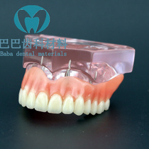 Cultivation body repair model to cover denture oral model Oral dental repair model One