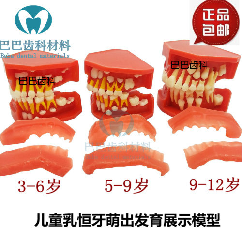 Child deciduous tooth replacement tooth model Alternate display of deciduous permanent teeth Oral 5-9 pulp dentition development model