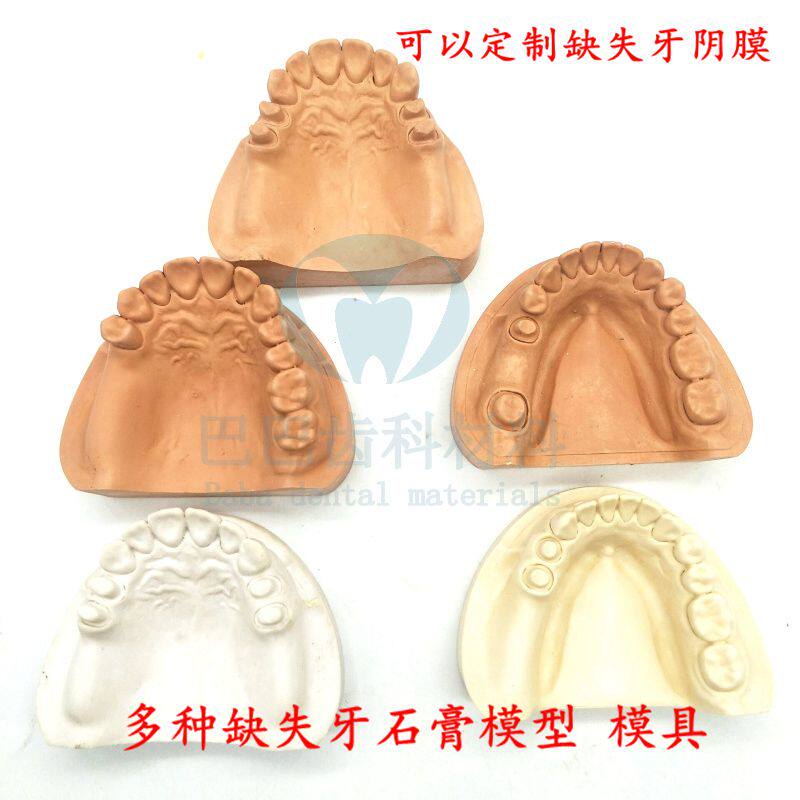 Dental plaster model Missing tooth plaster model Standard missing tooth model Teeth teaching exercise