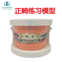 Dental Oral Orthodontic Orthodontic Practice Model With Metal Tortrough With Bow Wire Denture Model Teaching