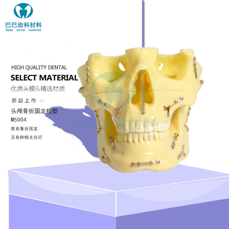 Dental Skull Fracture Fixation Model Skull Oral Cavity Model Medical Teaching Cultivation Support Nail 