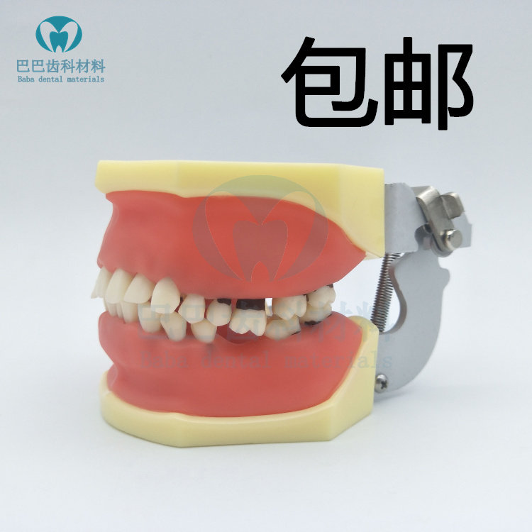 Dental oral model periodontal disease model practice dental calculus scraping of soft gum doctor-patient communication