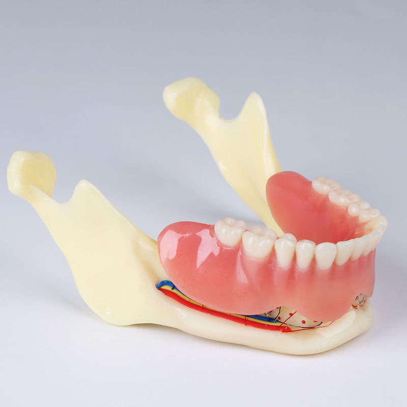 Dental model resin mandible denture cover model mandible with nerve model display denture removable