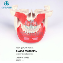 Dental branch anti-nail model practice model Foam plastic imitation bone silicone skin oral teaching practice model