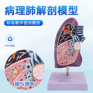 人体气管和肺 肺解剖病理肺吸烟者肺切面内科呼吸系统模型肺部