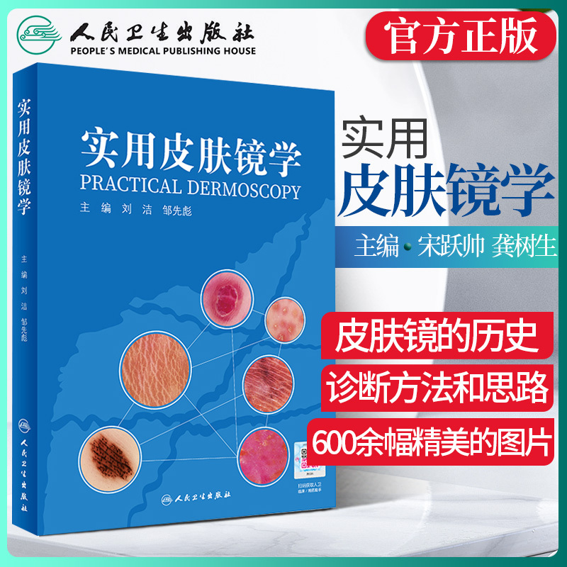 Practical Dermoscopy Liu Jie Zou Xianbiao Melanoma Seborrheic Keratosis Angioma Psoriasis Chloasma Hair and Nail Diseases Xinhua Dermoscopy Atlas Dermatology Books Practical Dermatology in China