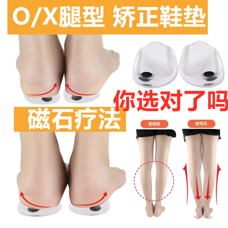 Adult Children Xo Type Leg Correction Instrumental Flat Foot Correction Magnetotherapy Insole Kid Foot Arch Inner 8-footed inner valgus