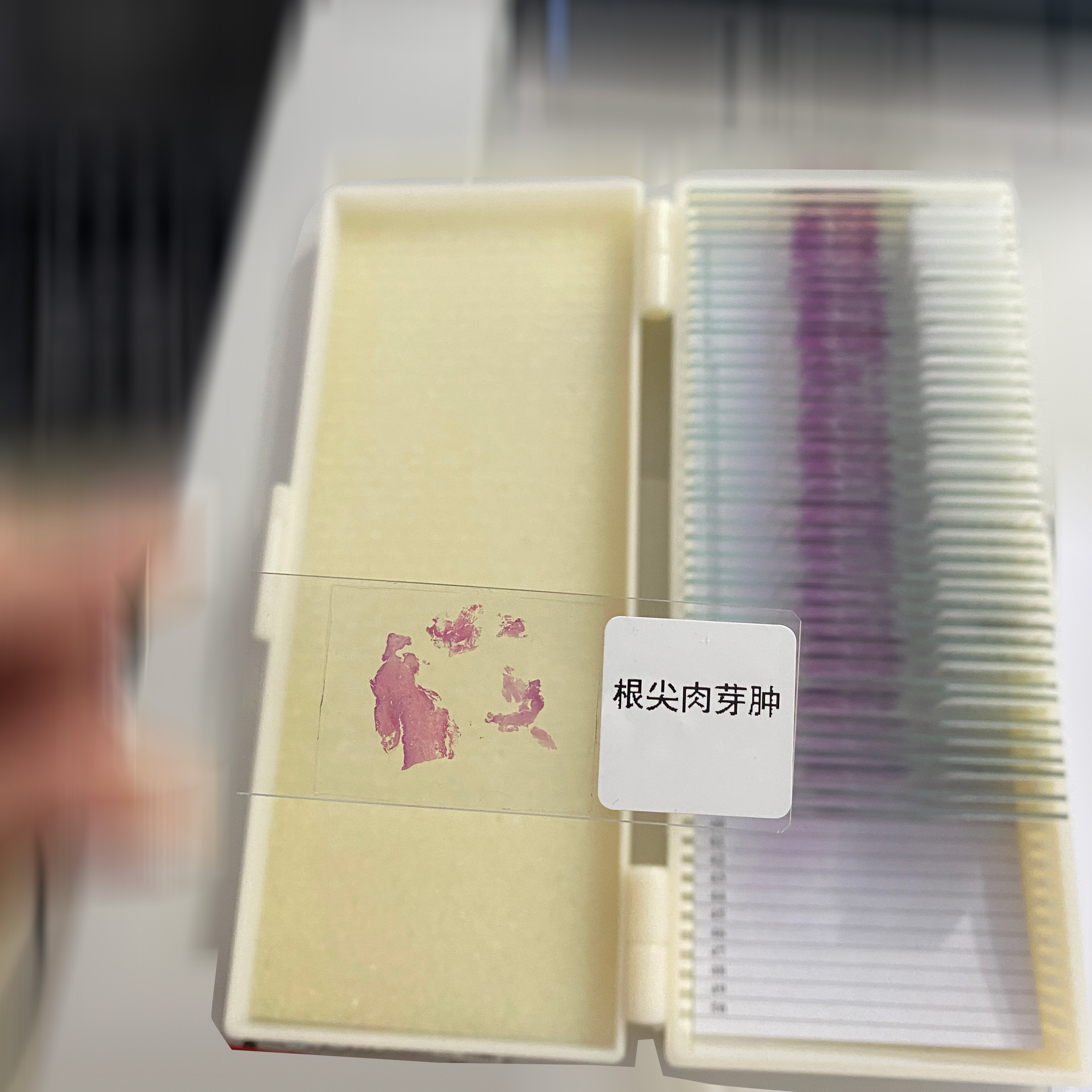 生物显微镜配件口腔病理镜下结构标本切片玻璃载玻片医学实验