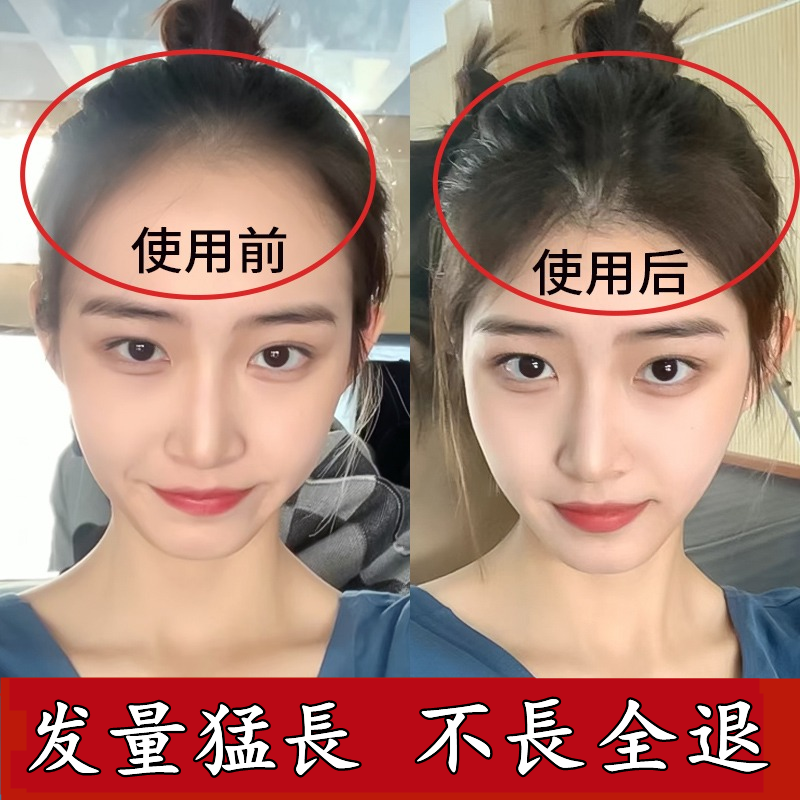 (short I eat) hair natural growth speed between men and women hair speed Mie-Taobao
