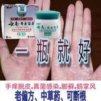 999 Piyanping itching skin allergy Sanjiu Piyanping fungal infection pruritus 999 Piyanping gel
