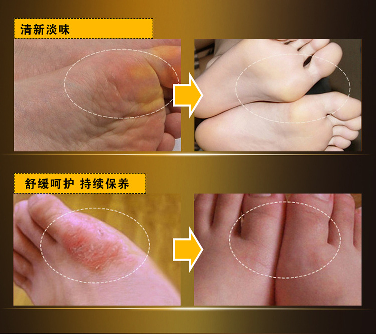 Kem dưỡng da tẩy tế bào chết cho da chân vàng 24K tẩy tế bào chết mềm mịn chân chống khô chân thuốc trị nẻ gót chân
