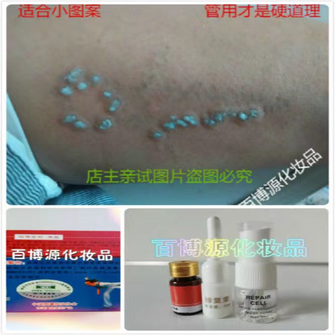 Tattoo Fading Magic Tool, Tattoo Removal Liquid, Tattoo Ink Remover, Old Tattoo Removal, Small Tattoo Removal, Tattoo Ink Fading Cream