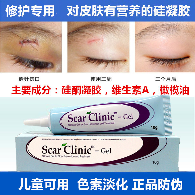 Korea imported Kelini to double eyelid surgery hyperplasia adenocarcinoma child scar repair gel Child scar cream