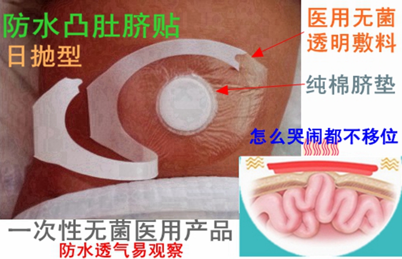 Medical infant umbilical hernia patch waterproof disposable convex belly button kid type gas belly button navel gas with drum belly button