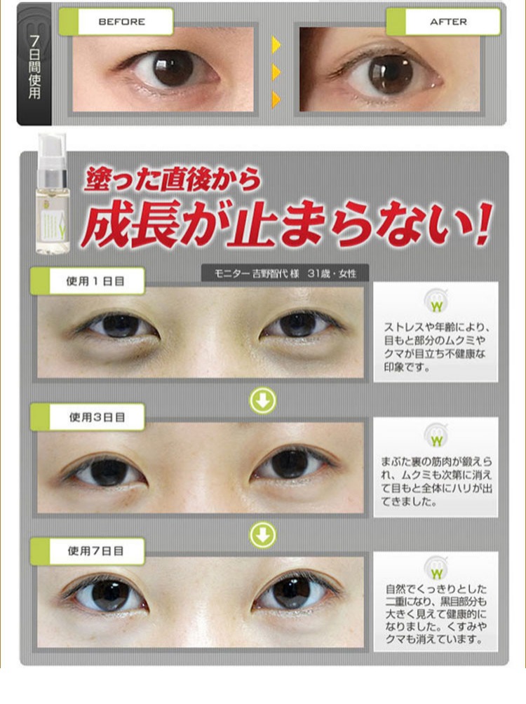 Nhật Bản Melty Wink Eye Makeup Eye Cream Chăm sóc mắt Firming Eye Care mặt nạ đắp mắ