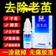 Yunnan Materia Medica Cocoon Youqing Chicken Eye Flesh Prick Body Liquid Plantar Wart Liquid Warts Chicken Eye Cream Toe Warts Foot Nail Chicken Youjing