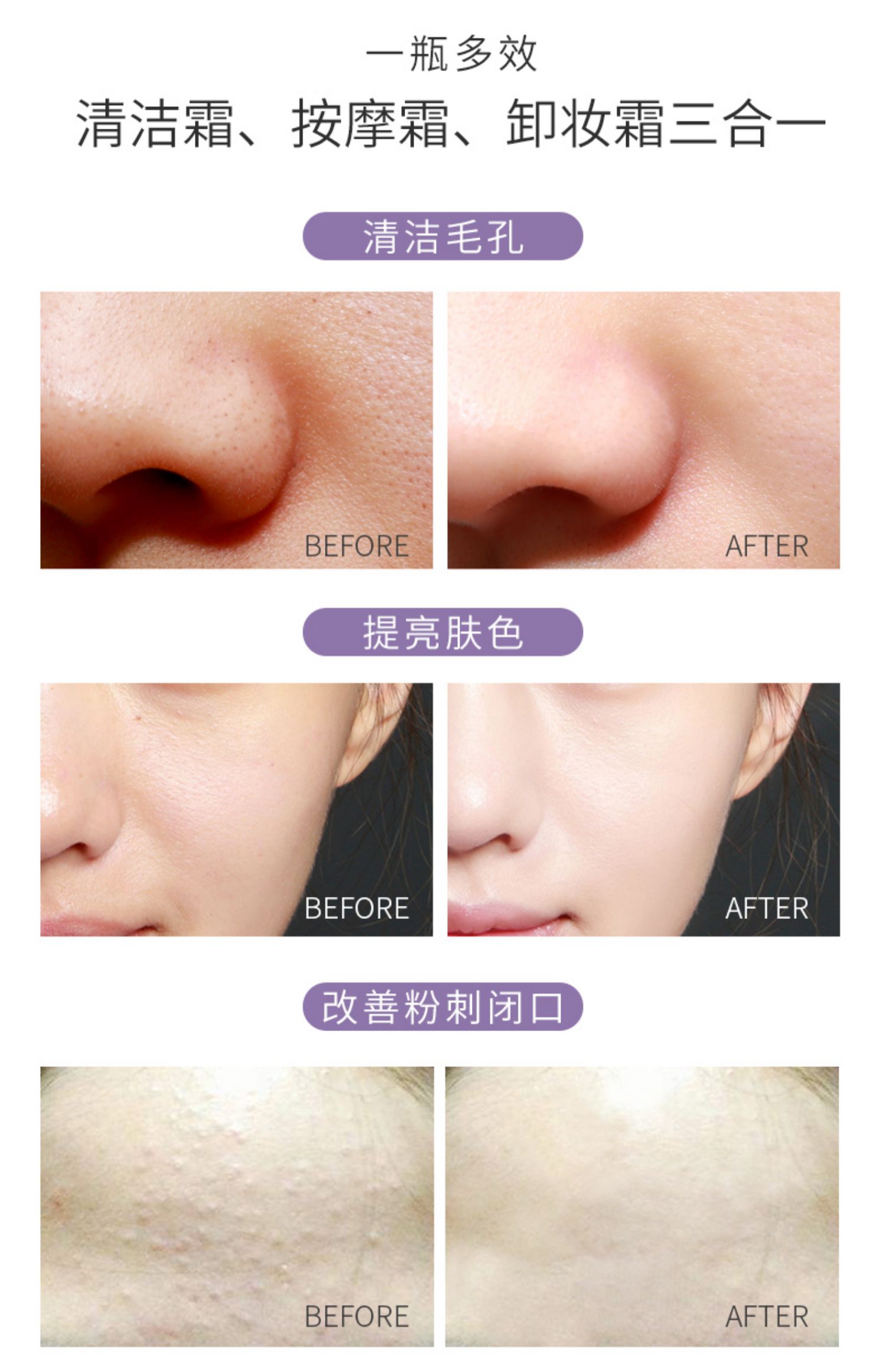 Ice Beauty Enzyme Cleansing Cream Nữ Deep Pore Discharge Cleansing Sữa Beauty Salon Special Massage Cream chính hãng - Kem massage mặt kem massage mặt