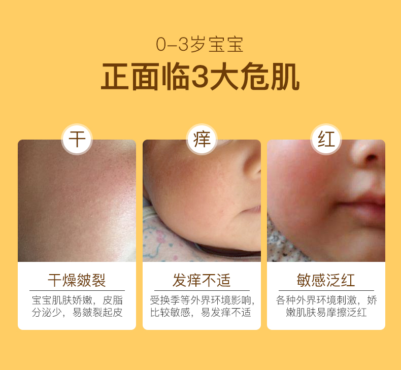 青蛙王子 宝宝润肤乳面霜两件 图2