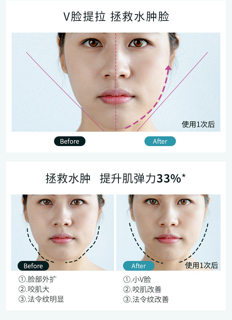 【日本直邮】雅萌 YA-MAN 吃鸡面罩瘦脸神器仪面膜面具美容V脸部提拉紧致去法令纹Medilift