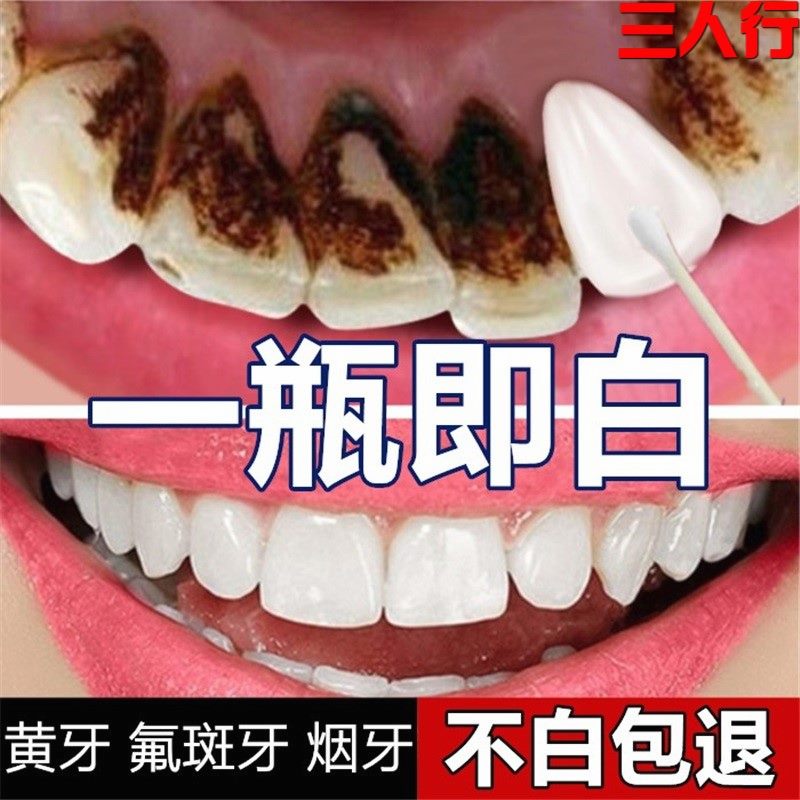 Toothpaste, whitening, yellow teeth toothpaste, whitening teeth, removing yellow and smoking, removing yellow and smoke stains, white teeth are more beautiful