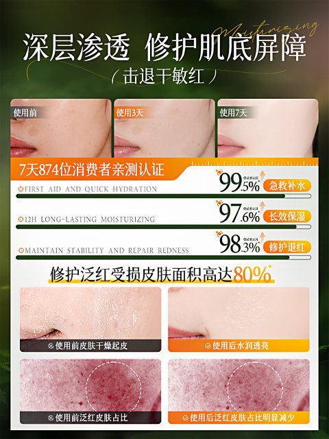 Hyaluronic acid molecule hydrating molecule ນໍ້າຢາບຳລຸງຜິວກ່ອນແຕ່ງໜ້າ centella asiatica toner ບັນເທົາຄວາມອ່ອນໄຫວ ແລະ ບັນເທົາອາການແດງ ຜະລິດຕະພັນຂອງແທ້ຈິງ