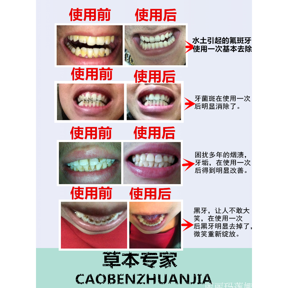 牙渍一擦即除？烟渍茶渍咖啡渍全搞定，牙齿变白真有这么神？