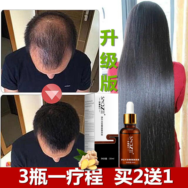 Hair growth liquid prevents hair loss, thickens hair, quickly grows short hair and grows long hair