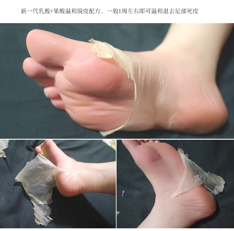 Nửa mẫu Anh hoa lĩnh vực để chết da chân cũ phim lột chăm sóc bàn chân dịu dàng feet chân tẩy tế bào chết dịu dàng mắt cá chân mặt nạ bộ thuốc trị nứt chân