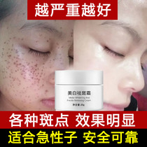 Whitening and freckle removal cream national makeup special brand powerful to lighten melanin chloasma freckles and freckles removal cream