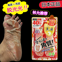 Lin Yun-tongs Japanese horse oil foot peeling foot film tender white foot film to die skin and cocoon to keratinocytes