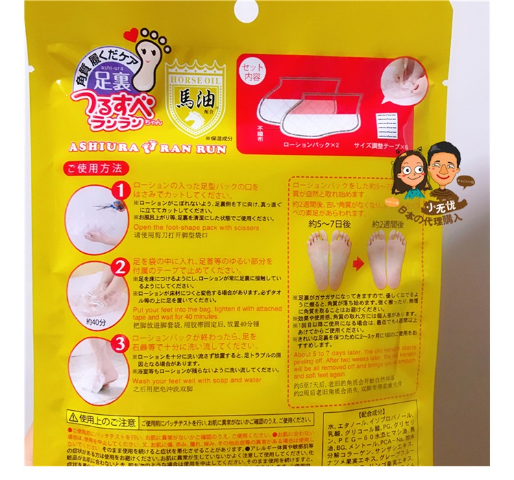 Lin Yun đề nghị Nhật Bản dầu ngựa chân phim foot foot tẩy tế bào chết callus tẩy tế bào chết làm trắng giữ ẩm mặt nạ chân mặt nạ ủ chân