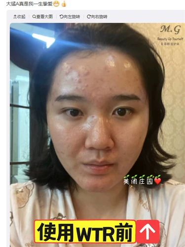 Таможенный склад!0,5%Алкогольная антиолд -модель Zo Skin WTR Мощная омоложение кожи Visual Yellowol 50 мл